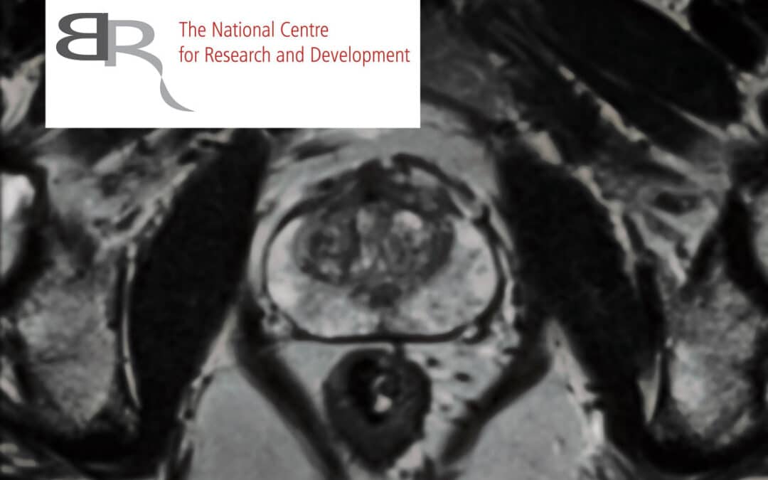 Diagnostics of prostate cancer-a picture with The National Centre of Research and Development logo
