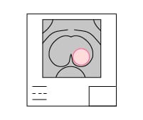 Drawing of prostate MRI