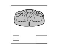 radiologyGraf-05 Drawing of prostate MRI